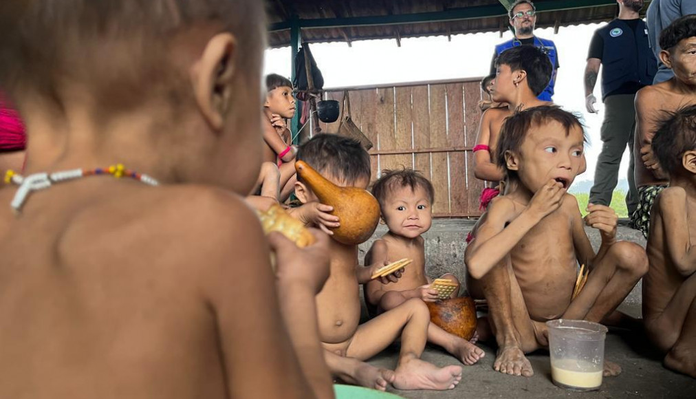 Le peuple yanomami, en Amazonie brésilienne, souffre de dénutrition / Junior Hekurari